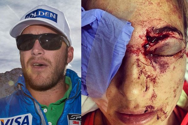Bode Miller ramte konen Morgan lige i øjet med en golfbold. Foto: Ikke oplyst